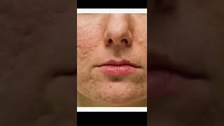 3 best skin lightening creamskincareproducts trendingviral shots [upl. by Rehpotsirc]