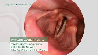 Disfonía Lesiones de las cuerdas vocales [upl. by Stempien]