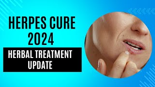 Herpes Cure 2024  Herbal Treatment Update [upl. by Dupuis856]