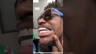 Kodak Black Shows New Grills [upl. by Tilden]