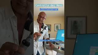 Controllo dei Nevi in Dermatoscopia dermatoscopia dermatologia epiluminescenza [upl. by Theodosia]