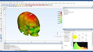 How to Analyze Model Thickness  Mimics Innovation Suite  Materialise Medical [upl. by Delp]