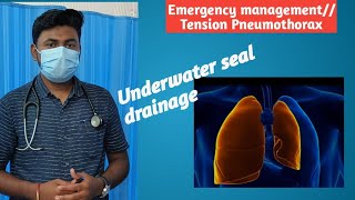 Tension Pneumothorax Emergency management [upl. by Hartman]