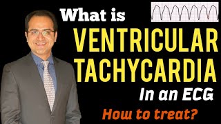 Ventricular Tachycardia VT ECG Interpretation Treatment ACLS Management Lectures USMLE NCLEX [upl. by Meryl]