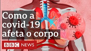 Em 3 minutos entenda como a covid19 afeta o corpo humano [upl. by Acir261]