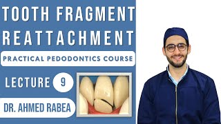 Lecture 09  Tooth Fragment Reattachment  كورس بيدو عملي [upl. by Nnyleimaj758]