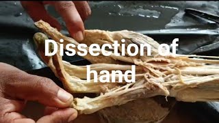 Dissection of hand Muscle of hand Anatomy of hand [upl. by Oralie]