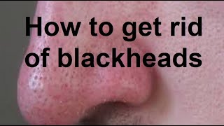 How To Get Rid and Blackheads [upl. by Ardnama902]