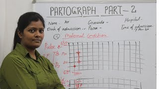 Partograph Part 2 in hindi  पार्टोग्राफ को कैसे भरे  Key Point of Partograph [upl. by Pooh]