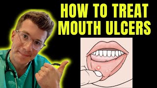 How to recognise and treat Mouth Ulcers getting rid of canker sores  Doctor ODonovan explains [upl. by Wanids]