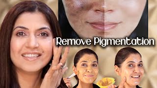 Get Rid of Melasma Pigmentation Discolouration Easily Home Remedy 2024  Ghazal Siddique [upl. by Alyakim]