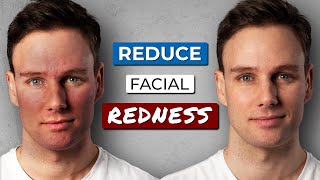 How to GET RID OF REDNESS on your FACE [upl. by Eiliab]