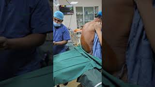 Spinal Anaesthesia for Low Cardiac Reserve patient low EFanesthesia spinal [upl. by Ahras97]