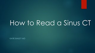 How to read a Sinus CT [upl. by Simara]