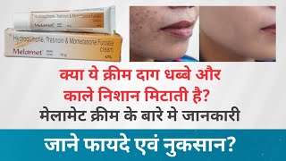 Melamet Cream के बारे मे जानकारी क्या ये क्रिम गोरा होने मे मदद करती है जाने फायदे एवं नुकसान [upl. by Nasas261]