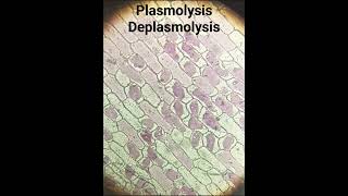 Plasmolysis Deplasmolysis [upl. by Rakia]