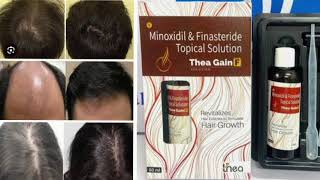 Thea Gain Minoxidil and Finasteride Topical Solution [upl. by Ynafetse834]