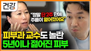 quot막을 수 없는 노화 하지만 젊어질 수 있다면quot 피부과 교수가 말하는 피부 젊어지는 방법 3가지｜귀하신 몸｜EBS건강 [upl. by Abbi]