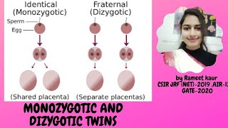 Monozygotic and Dizygotic twins [upl. by Onabru]