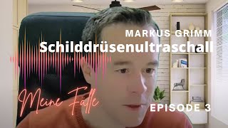 Schilddrüsenultraschall mit Markus Grimm Ep3 [upl. by Enrev500]