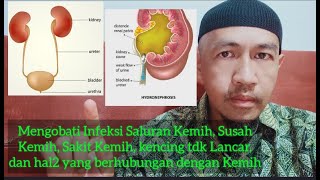 Pengobatan Saluran Kemih URETER Saluran Air Seni [upl. by Mauri869]