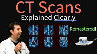 High Resolution CT Scan HRCT Explained Clearly  Remastered [upl. by Inalial]