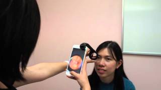 visoScope Smartphone Ophthalmoscope [upl. by Ahsauqal]