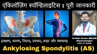 एंकिलॉज़िंग स्पॉन्डिलाइटिस  पूरी जानकारी  All about Ankylosing Spondylitis  HLAB27 Arthritis [upl. by Portwine260]