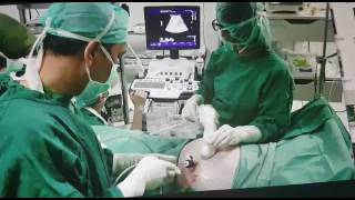 Fetoscopy by dr Gatot Abdurrazak SpOGK [upl. by Lewej]