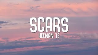 SCARS by Keenan Te ft Peder Elias [upl. by Nrehtac]