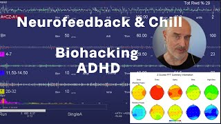 Neurofeedback amp Chill Biohacking ADHD [upl. by Cybill]