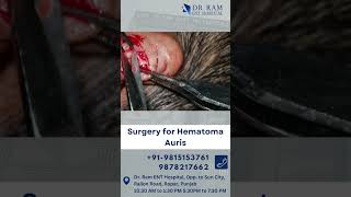 Surgery for Hematoma Auris ent hospital Drramenthospital [upl. by Yeorgi]