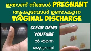 2 Types Of Pregnancy Discharge Deechus world Malayalam [upl. by Nyrmac]