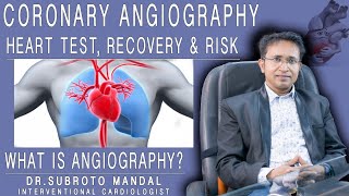 What is angiography and how is it done   Coronary Angiography Heart Test Recovery amp Risk [upl. by Janek]