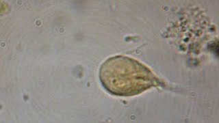 Giardia Lamblia CIAB wwwciabes [upl. by Kentigerma]