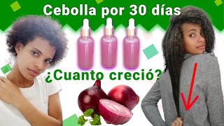 Shampoo de Romero Para el Crecimiento del Cabello [upl. by Luzader]