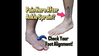 After Ankle Sprain and Surgery Check Your Foot Alignment [upl. by Akima711]