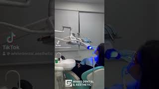 Pastrimi i gurezave dhe zbardhimi i dhembeve me 50 ulje dentis laserhairremoval [upl. by Nylaf128]