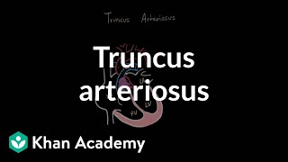 Truncus arteriosu  Circulatory System and Disease  NCLEXRN  Khan Academy [upl. by Salahcin]