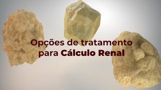 Opções e tratamento para CÁLCULO RENAL [upl. by Mikal]