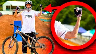 HO LESIONATO IL NERVO DEL BRACCIO  Crankworx Cairns 2024 [upl. by Cathryn]