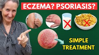 STOP Eating This To Cure all Your Skin Problems Like Eczema Psoriasis  Dr Barbara ONeill [upl. by Paff]