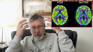 Dr Bessel Van Der Kolk  How To Heal Trauma Without Medication [upl. by Felicio]