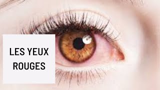 Les yeux rougesLes causes passagères et bénignes de lœil irrité [upl. by Falzetta826]