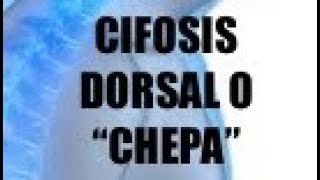 Ejercicios para la cifosis dorsal [upl. by Ettevroc]