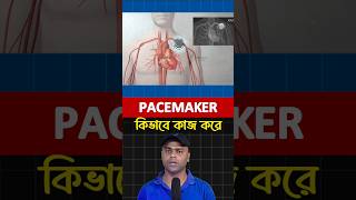 Pacemaker কিভাবে কাজ করে [upl. by Aicenra]