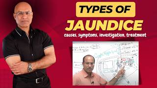 Types Of Jaundice  Causes Symptoms amp Treatment  Dr Najeeb [upl. by Mcnully]