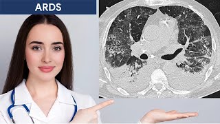 Acute Respiratory Distress Syndrome ARDS Imaging [upl. by Tnelc]