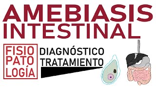 Amebiasis intestinal  Fisiopatología diagnóstico y tratamiento [upl. by Lebbie969]