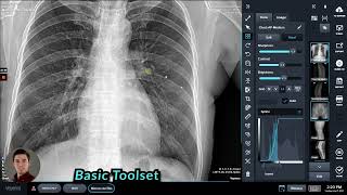 Voyance Digital Xray  Toolset Full Overview [upl. by Germain]